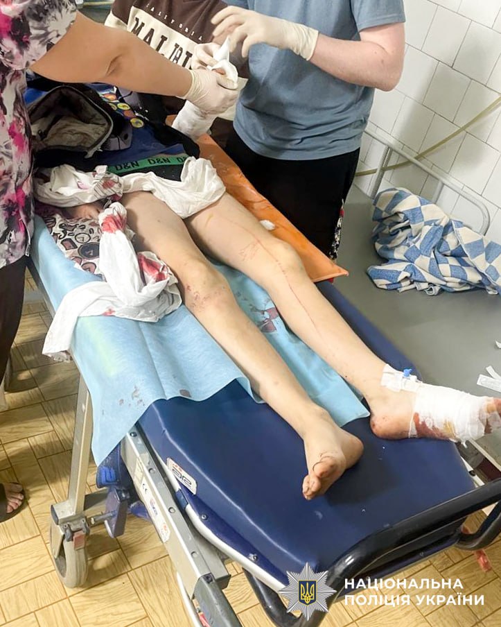 Німецька вівчарка та ротвейлер покусали дітей на Рівненщині 2
