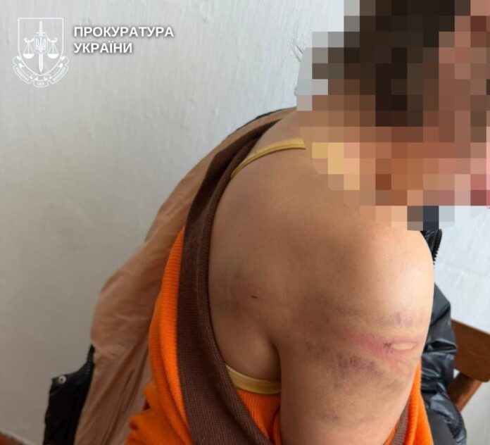 побив 16-річну доньку гумовим шлангом