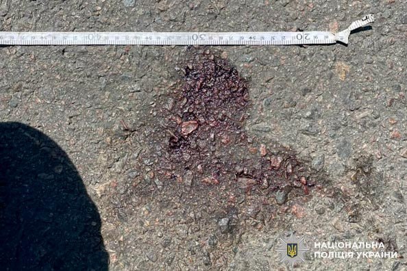 Поліція фіксує обставини аварії з постраждалими