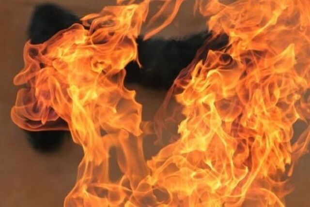 Жителька Рівненщини отримала опіки спалахнула пожежа